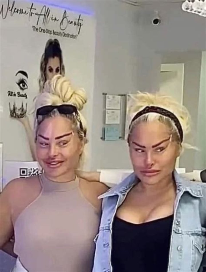 Darcey And Stacey Before And After Plastic Surgery 2021? Parents Nationality & Ethnicity