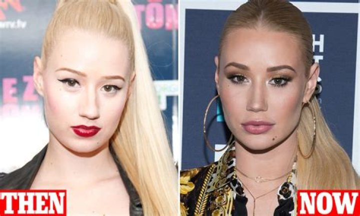 What Happened To Iggy Azalea And Why Is She Taking A Break? Status Update On The Singer