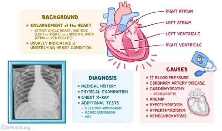 
What is cardiomegaly? Causes explored as Jansen Panettiere’s cause of death is revealed 
